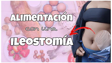 ¿Qué no comer con una bolsa de ostomía?