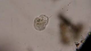 UROCENTRUM Protozoa