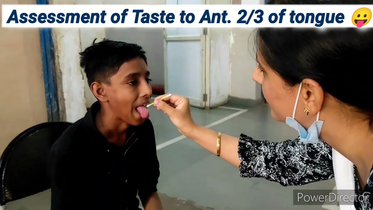 CNS Examination in children I VII Cranial Nerve Examination | Facial Nerve Palsy | Pediatrics