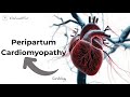 Peripartum Cardiomyopathy