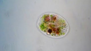 Holophrya | Under Microscope