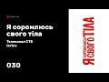 Ихтиоз, " Я соромлюсь свого тіла", телеканал СТБ