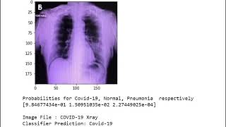 Covid 19 Classification Model - DenseNet121