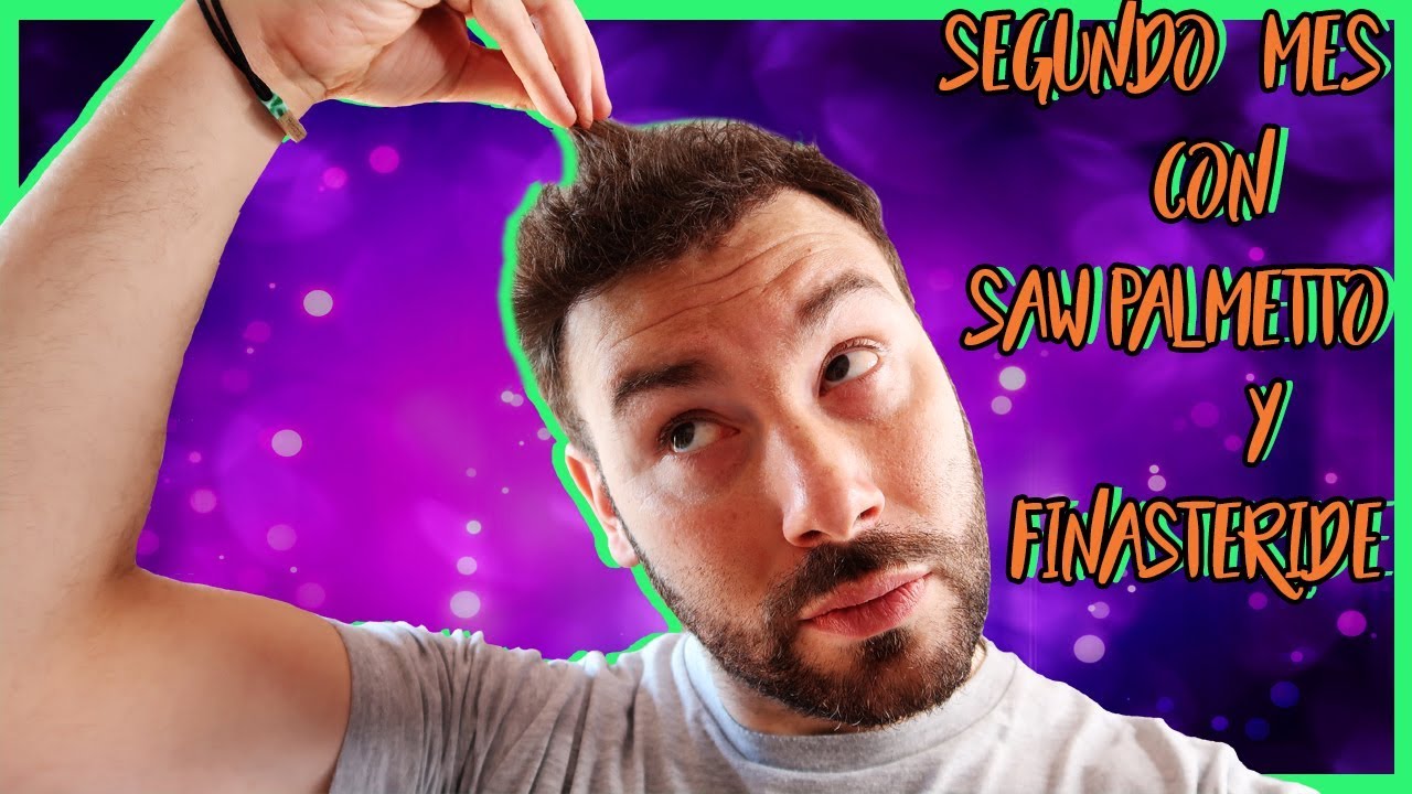SEGUNDO mes con FINASTERIDE y SAW PALMETTO juntos YouTube