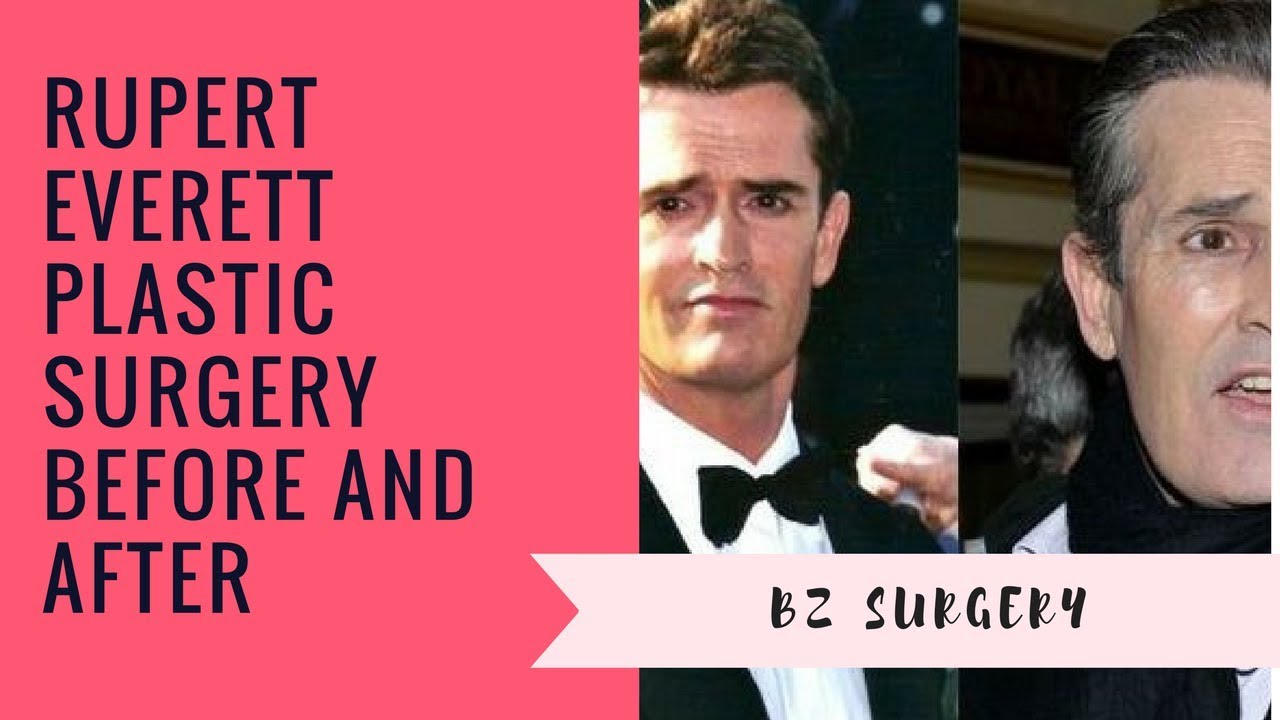 Rupert Everett Plastic Surgery Before and After YouTube