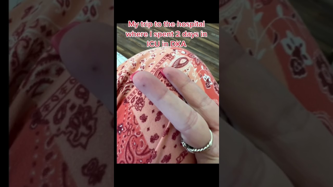 If you are diabetic, follow my journey #diabetes #diabetic #dka #ketoacidosis #icu #hospitaltrip