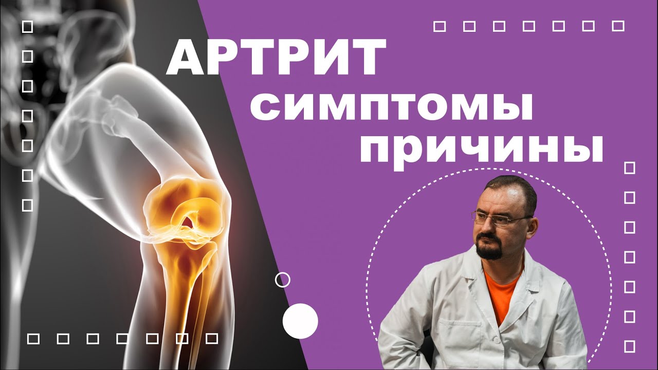 Артрит - воспаление сустава. Причины и проявления артрита. - YouTube