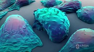 Nanoparticle-based drug delivery in the fight against cancer screenshot 4