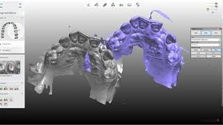 3Shape Scan Alignment