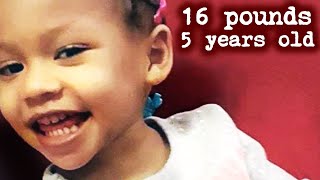16 Pounds At 5 Years Old: The Sickening Case of Cali Anderson