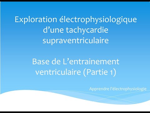 Exploration électrophysiologique d&rsquo;une TSV : Base de l&rsquo;entrainement ventriculaire (Partie 1)