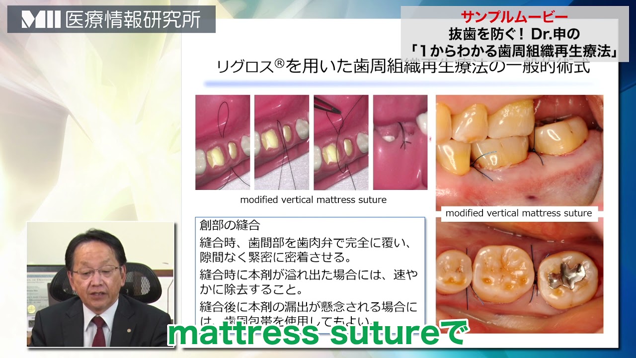 株式会社 医療情報研究所 | 抜歯を防ぐ！Dr.申の「1からわかる歯周