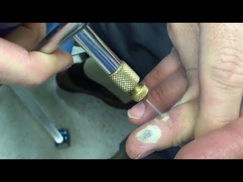 Axis' Finger Warts, Macro Lens! Big Game Prediction!