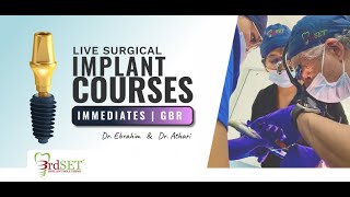Dental Implant Courses with personalized mentorship