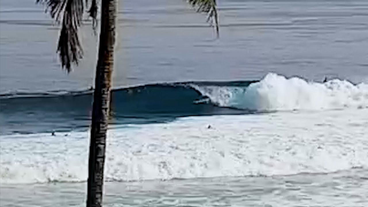 Clips
