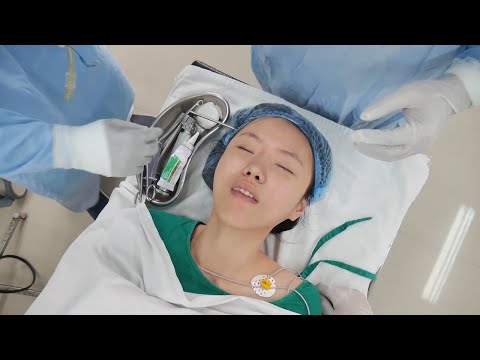 Putting a Girl into Deep Sleep - General Anesthesia - Intubation