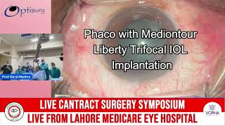 Unlocking Crystal Clear Vision: Live Trifocal IOL Cataract Surgery-Lahore Ophthalmo 23 screenshot 1