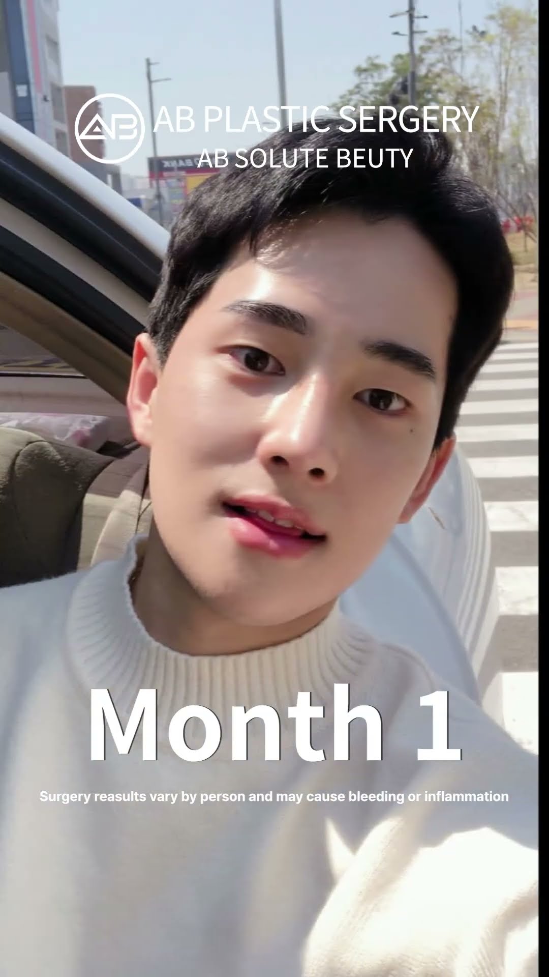 Jaw-Dropping Glow-Up! Nose & Jaw Surgery #shorts