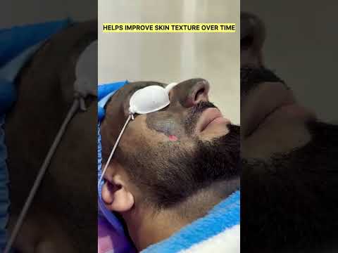 Real patient results at Elanora MedSpa Kupwara — click to play