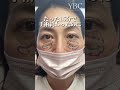 【目の下のたるみ】クマ取ったらマジで後悔した #shorts