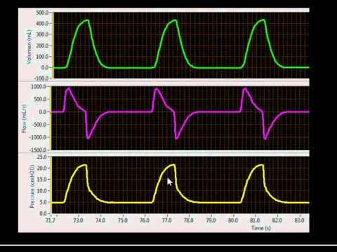 Ventilator Mode Classification: Breathing Patterns