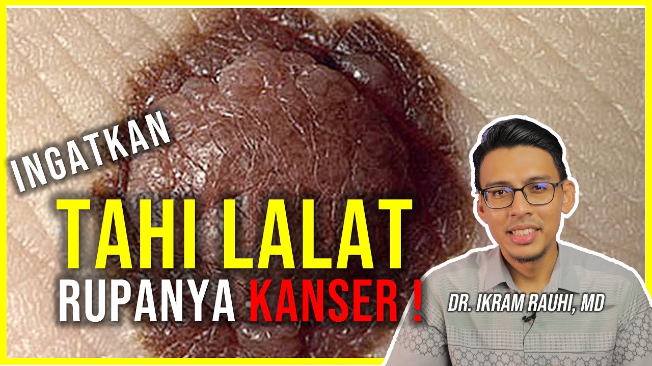 Beza Tahi Lalat Yang Bahaya dan Normal