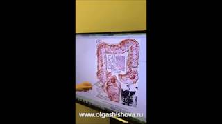 Заболевания желудочно- кишечного тракта. Папилломатоз. Заболевания желудочно- кишечного тракта. Папилломатоз.