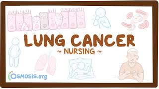 Lung Cancer: Nursing