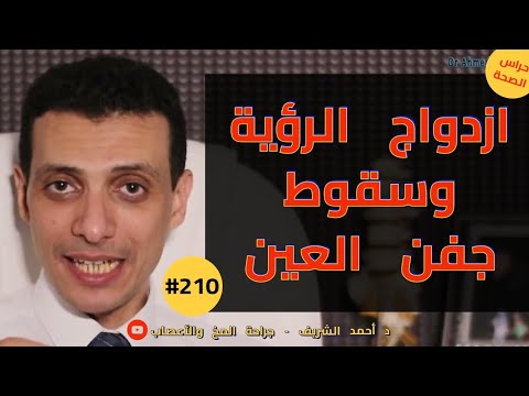 ازدواج الرؤية والصداع بسبب اعتلال العصب الثالث أو الرابع أو السادس د أحمد الشريف 210