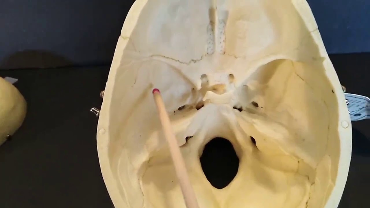 Bone Features of the Skull video 2 - YouTube