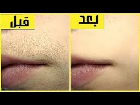 قناع النشا لتبييض الوجه وشد البشرة وتصغير المسامات ستبهرك نتيجته | تبييض البشرة فوري بالنشا. 