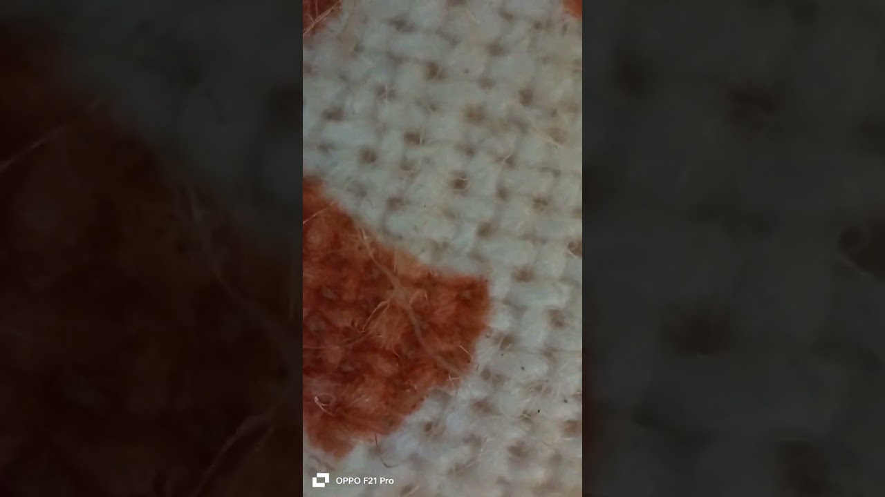 blanket in microscope tell me what next 