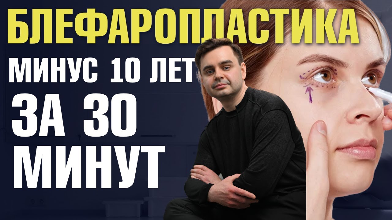 Блефаропластика верхних и нижних век | Реабилитация после пластики век. Доктор Золотов Сергей