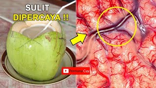 Simak Baik Baik  ! Minum Air Kelapa Selama 6 Hari Apa Yang Terjadi