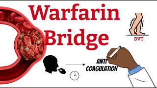 Why do we bridge Warfarin - Fast simple explanation