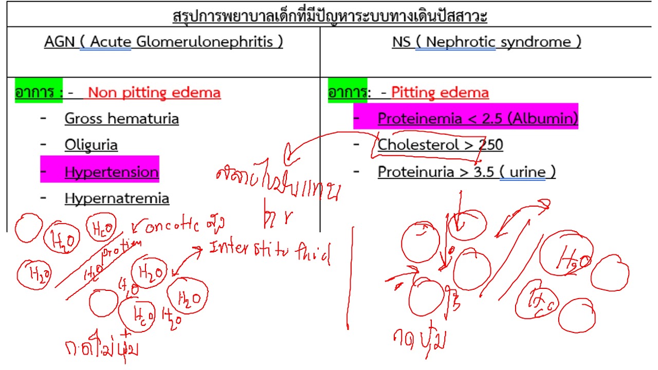 สรุปการพยาบาลเด็กที่มีปัญหาระบบทางเดินปัสสาวะ