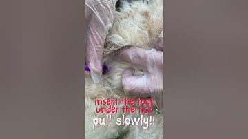 How to Remove a Tick Safely