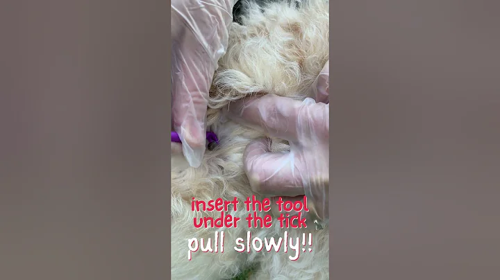 How to Remove a Tick Safely