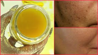 NO SOAP FACIAL WASH, APPLY TO FACE DAILY FOR DARK SPOTS, LARGE PORES, ACNE \& WRINKLES GET CLEAR SKIN