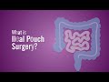 What is ileal pouch surgery