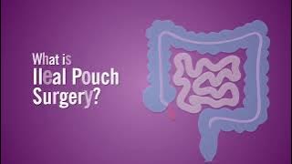 What is Ileal Pouch Surgery?