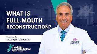 What Is Full-Mouth Reconstruction? | Mini Dental Implant Centers of America in Scranton, PA
