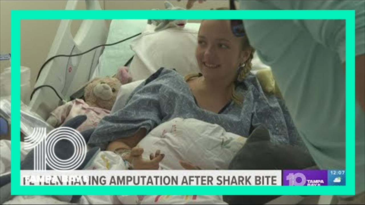 'She’s embracing it': Florida teen will have leg amputated after shark ...