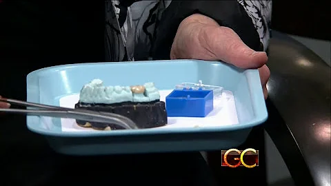 Dr. Jane L. Dodson: Dental Crowns