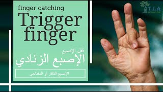 الإصبع  الزنادي أو الإصبع القافز أو المقداحي    Trigger finger (subtitled)