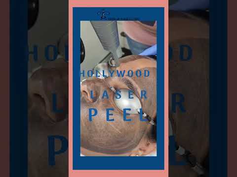Hollywood Laser Peel | Skin Care Treatment | Dermatologist |  AMI Skin & Hair Clinic