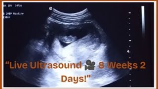 "8 Weeks 2 Days Pregnant: See Your Baby's First Movements!"