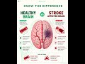 STROKE - THE HAPPY SCALPEL