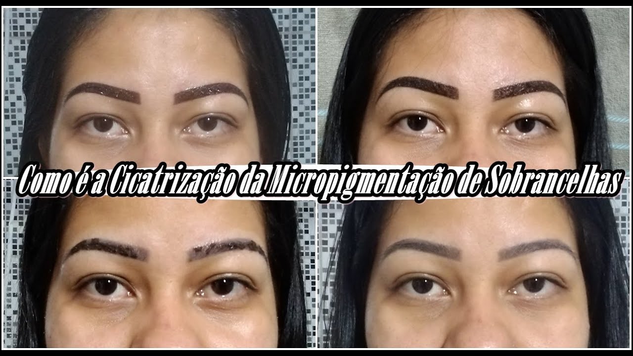 Diário da Cicatrização - Micropigmentação de Sobrancelhas