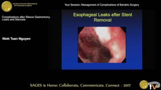 Complications after sleeve gastrectomy: Leaks & stenosis screenshot 1